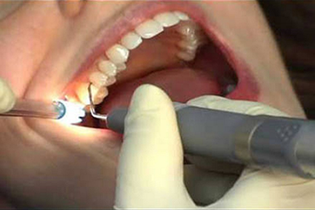 10 Tips That Will Change The Way You dentistry in Dwarka